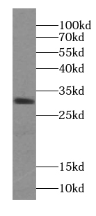 ZGLP1 antibody