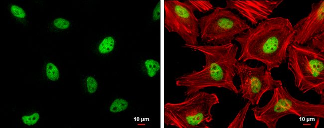 ZHX2 Rabbit Polyclonal Antibody