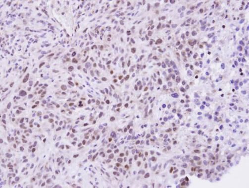 ZHX2 Rabbit Polyclonal Antibody