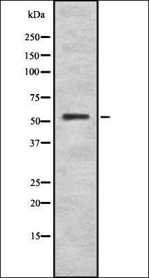 ZIC1/2/3/4/5 antibody