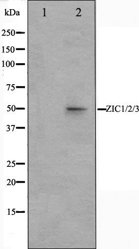 ZIC1/2/3 antibody