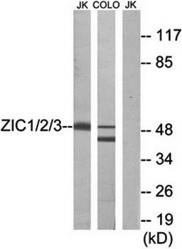 ZIC1/2/3 antibody