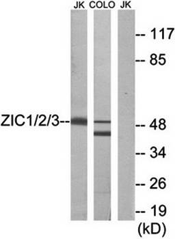 ZIC1/2/3 Antibody