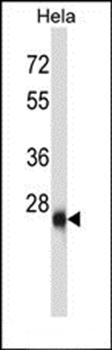 ZIC4 antibody