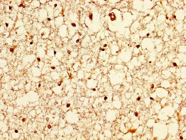 ZIC4 Antibody