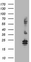 ZIM2 Antibody