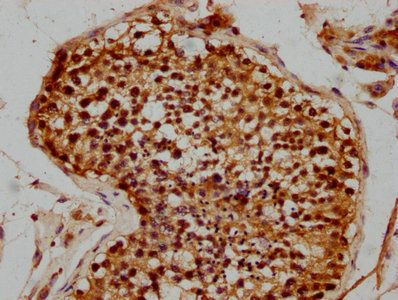 ZIM2 Antibody