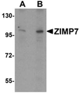 ZIMP7 Antibody
