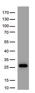 Zinc Alpha 2 Glycoprotein (AZGP1) antibody