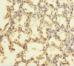 Zinc finger protein 114 antibody