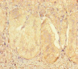 ZNF175 Antibody