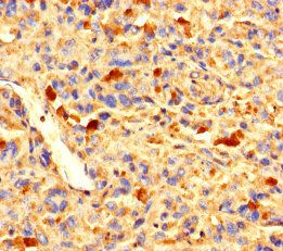ZNF384 Antibody