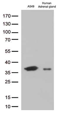 zinc finger protein 655 (ZNF655) antibody