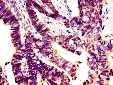 GLI1 Antibody