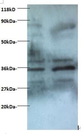 Zinc finger BED domain-containing protein 1 protein antibody (Biotin)