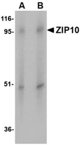 ZIP10 Antibody