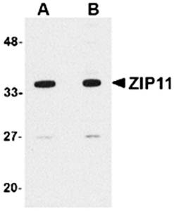 ZIP11 Antibody