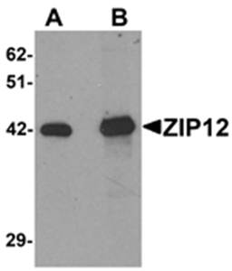 ZIP12 Antibody