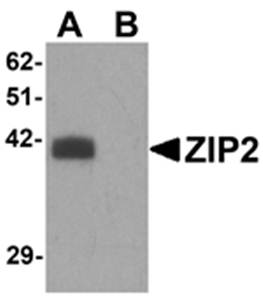 ZIP2 Antibody