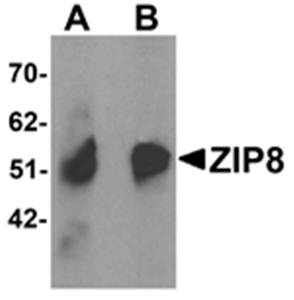 ZIP8 Antibody