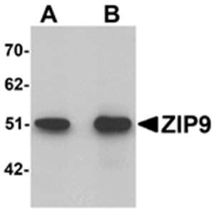 ZIP9 Antibody
