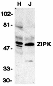 ZIPK Antibody