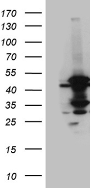 ZKSCAN1 Antibody
