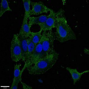 ZKSCAN3 Antibody