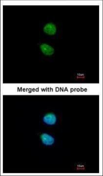 ZKSCAN3 antibody [N1C2]