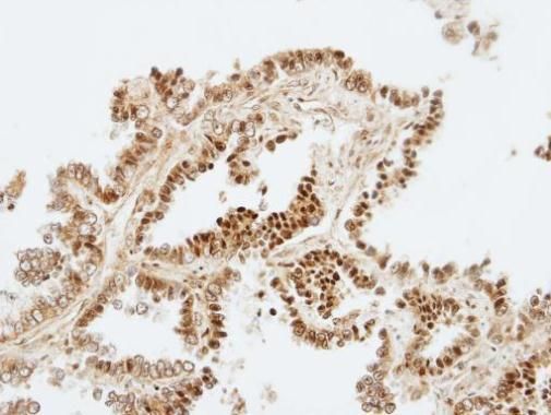 ZKSCAN3 Rabbit Polyclonal Antibody
