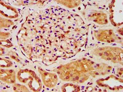 ZKSCAN5 Antibody