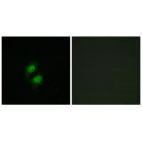ZKSCAN5 Antibody
