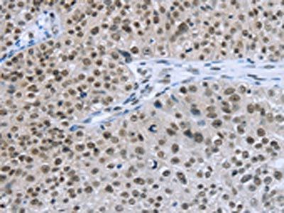 ZMAT3 Antibody