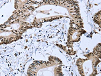 ZMAT3 Antibody