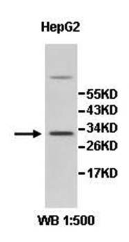 ZMAT3 Rabbit Polyclonal Antibody
