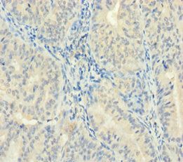 ZMAT5 Antibody