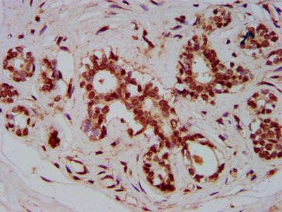 ZMIZ1 Antibody