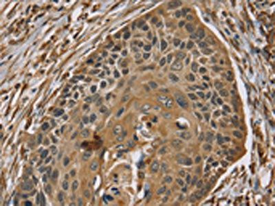 ZMIZ1 Antibody