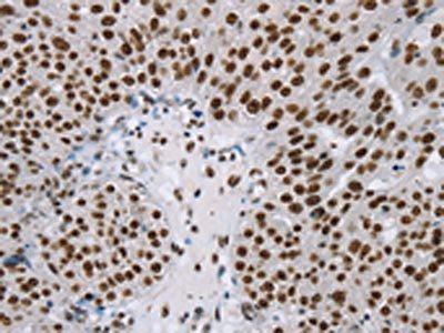 ZMIZ1 Antibody