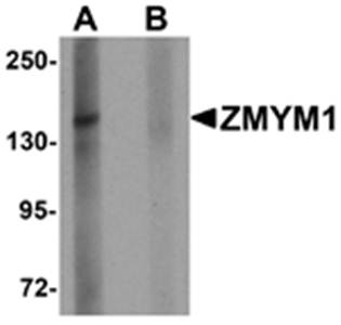 ZMYM1 Antibody