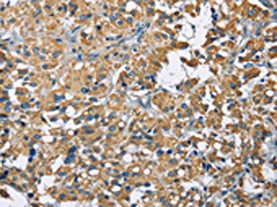 ZMYND11 Antibody