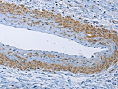 ZMYND11 Antibody