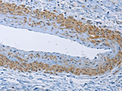 ZMYND11 antibody