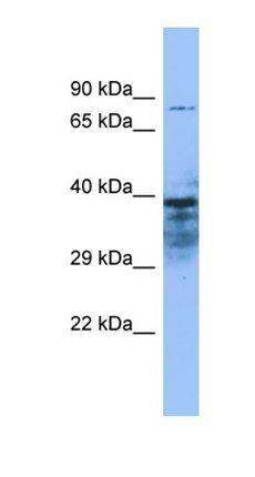 ZMYND15 antibody