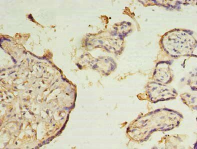 ZMYND19 Antibody