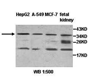 ZNF101 Rabbit Polyclonal Antibody