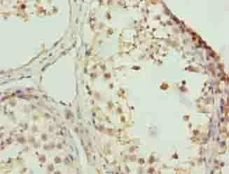 ZNF131 Antibody
