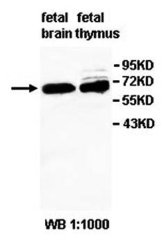 ZNF131 Rabbit Polyclonal Antibody