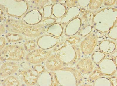 ZNF133 antibody