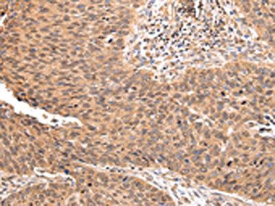 ZNF146 antibody